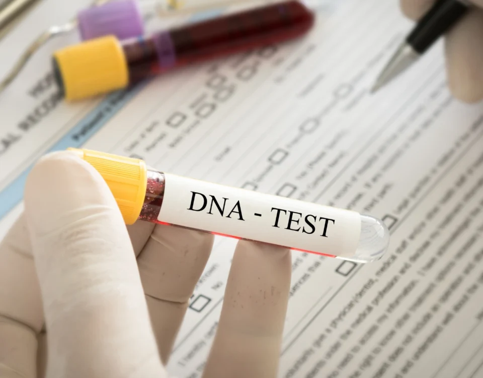 Babalık Davası ve DNA Testi 4 Evlilik dışı doğan çocuğun biyolojik babası ile soybağının kurulması amacıyla açılan babalık davası sürecini, mahkeme kararıyla Adli Tıp Kurumu tarafından yürütülen kan ve DNA profil incelemelerini sembolize eden; tıbbi laboratuvarda elinde "DNA - TEST" yazılı kan tüpü tutan eldivenli bir tıp uzmanını ve arka plandaki tıbbi evrakları gösteren kurumsal hukuk görseli.